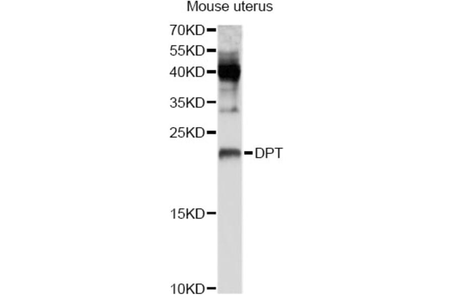 Western Blot - Anti-DPT Antibody (A8643) - Antibodies.com