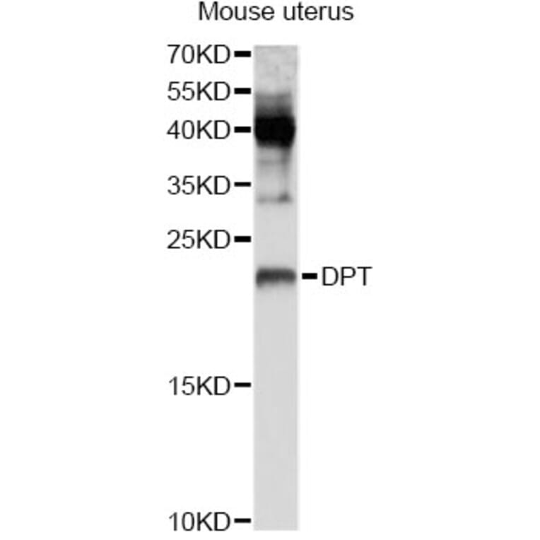 Western Blot - Anti-DPT Antibody (A8643) - Antibodies.com