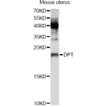 Western Blot - Anti-DPT Antibody (A8643) - Antibodies.com