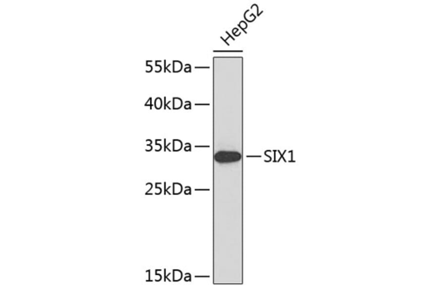 Western Blot - Anti-SIX1 Antibody (A8653) - Antibodies.com