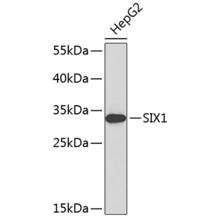 Western Blot - Anti-SIX1 Antibody (A8653) - Antibodies.com