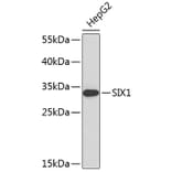 Western Blot - Anti-SIX1 Antibody (A8653) - Antibodies.com