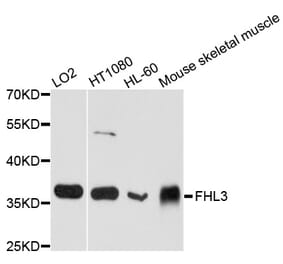 Western Blot - Anti-FHL3 Antibody (A8679) - Antibodies.com
