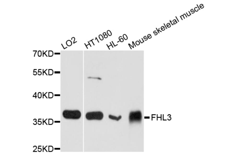 Western Blot - Anti-FHL3 Antibody (A8679) - Antibodies.com
