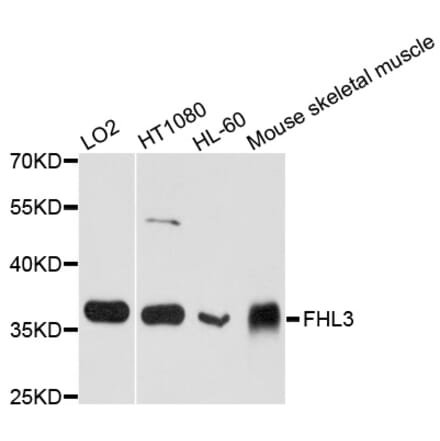 Western Blot - Anti-FHL3 Antibody (A12293) - Antibodies.com