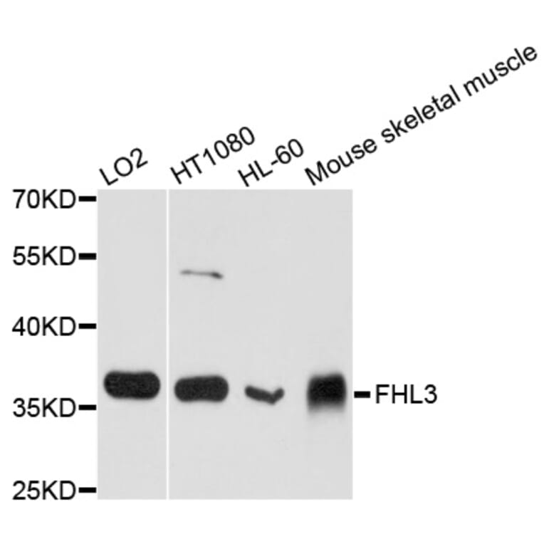 Western Blot - Anti-FHL3 Antibody (A8679) - Antibodies.com