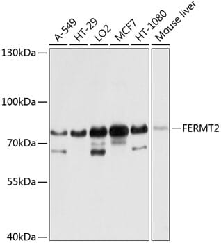 Western blot analysis of extracts of various cell lines, using Anti-FERMT2 Antibody (A8709) at 1:1,000 dilution.
Secondary antibody: Goat Anti-Rabbit IgG (H+L) (HRP) (AS014) at 1:10,000 dilution.
Lysates / proteins: 25µg per lane.
Blocking buffer: 3% non-fat dry milk in TBST.
Detection: ECL Basic Kit (RM00020).
Exposure time: 5s.