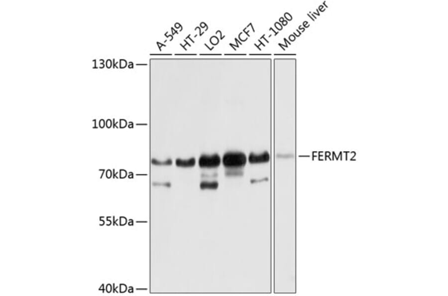 Western Blot - Anti-Kindlin 2 Antibody (A12294) - Antibodies.com