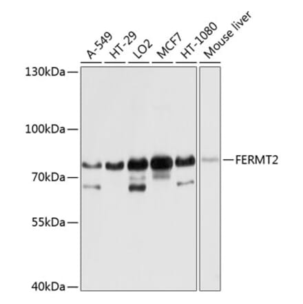 Western Blot - Anti-Kindlin 2 Antibody (A12294) - Antibodies.com