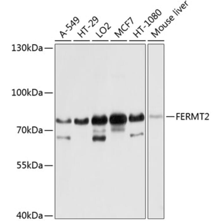 Western Blot - Anti-Kindlin 2 Antibody (A12294) - Antibodies.com