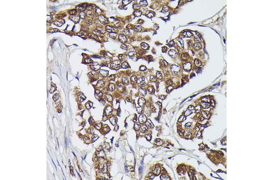 Immunohistochemistry - Anti-Kindlin 2 Antibody (A12294) - Antibodies.com