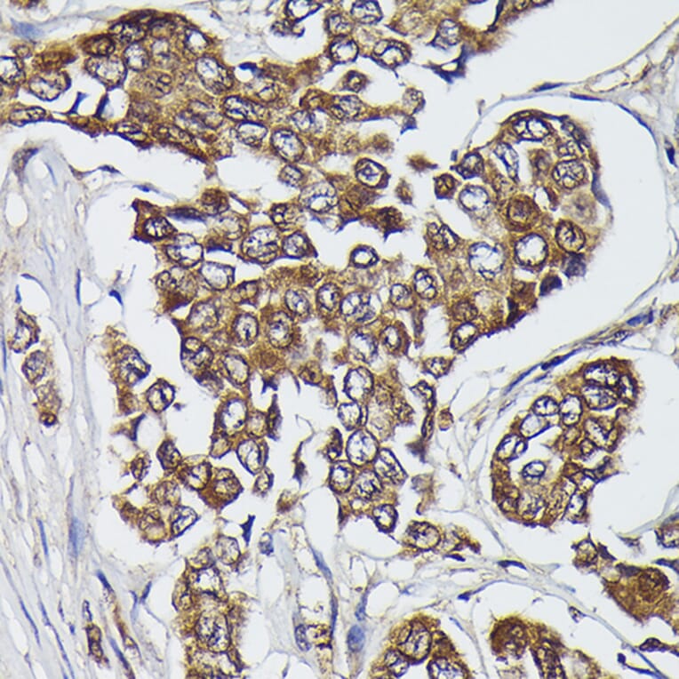 Immunohistochemistry - Anti-Kindlin 2 Antibody (A12294) - Antibodies.com