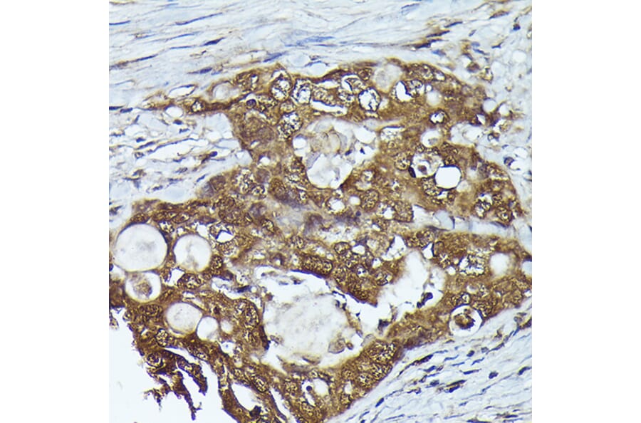 Immunohistochemistry - Anti-Kindlin 2 Antibody (A12294) - Antibodies.com