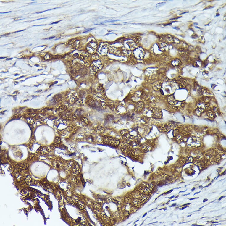 Immunohistochemistry - Anti-Kindlin 2 Antibody (A12294) - Antibodies.com