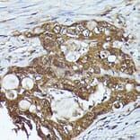 Immunohistochemistry - Anti-Kindlin 2 Antibody (A12294) - Antibodies.com