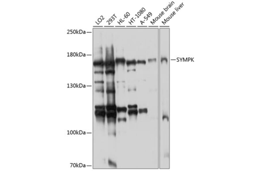 Western Blot - Anti-Symplekin Antibody (A12296) - Antibodies.com