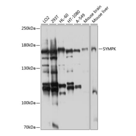 Western Blot - Anti-Symplekin Antibody (A12296) - Antibodies.com