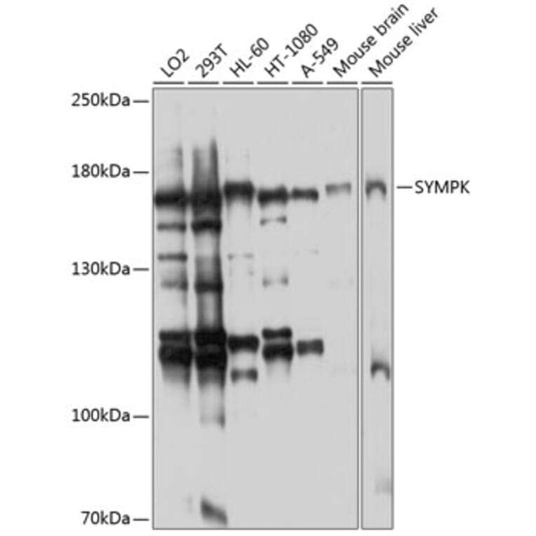 Western Blot - Anti-Symplekin Antibody (A12296) - Antibodies.com