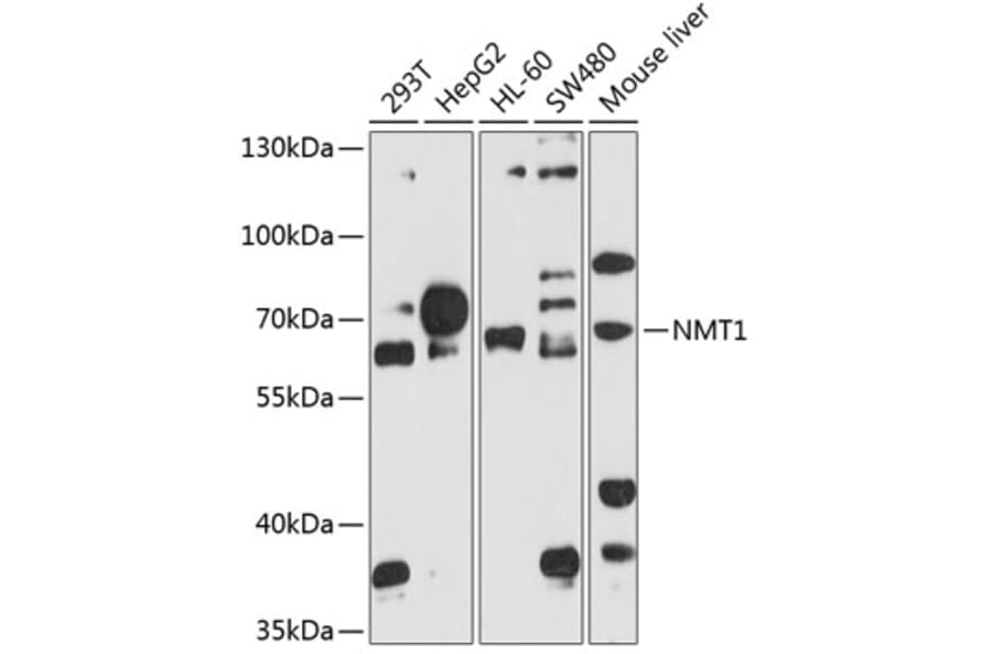 Western Blot - Anti-NMT1 Antibody (A8724) - Antibodies.com