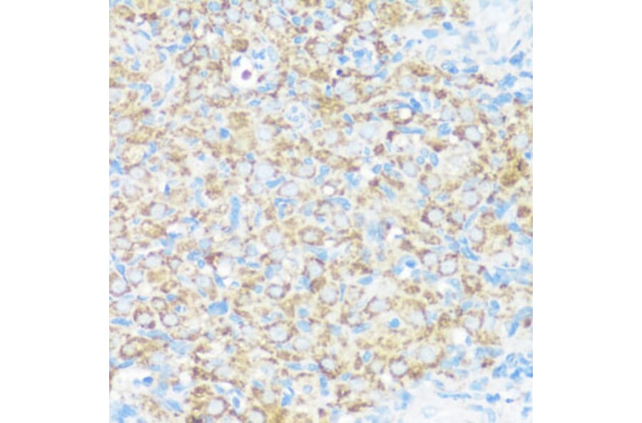 Immunohistochemistry - Anti-NMT1 Antibody (A8724) - Antibodies.com