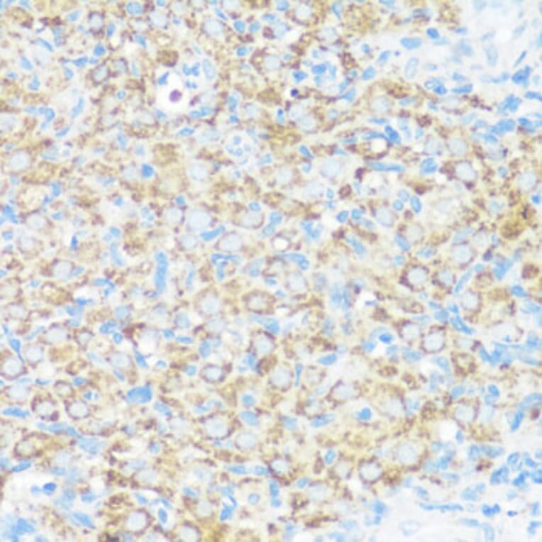 Immunohistochemistry - Anti-NMT1 Antibody (A8724) - Antibodies.com