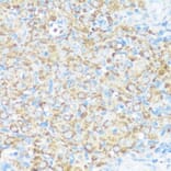 Immunohistochemistry - Anti-NMT1 Antibody (A8724) - Antibodies.com