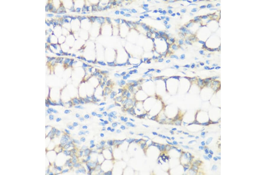 Immunohistochemistry - Anti-NMT1 Antibody (A8724) - Antibodies.com