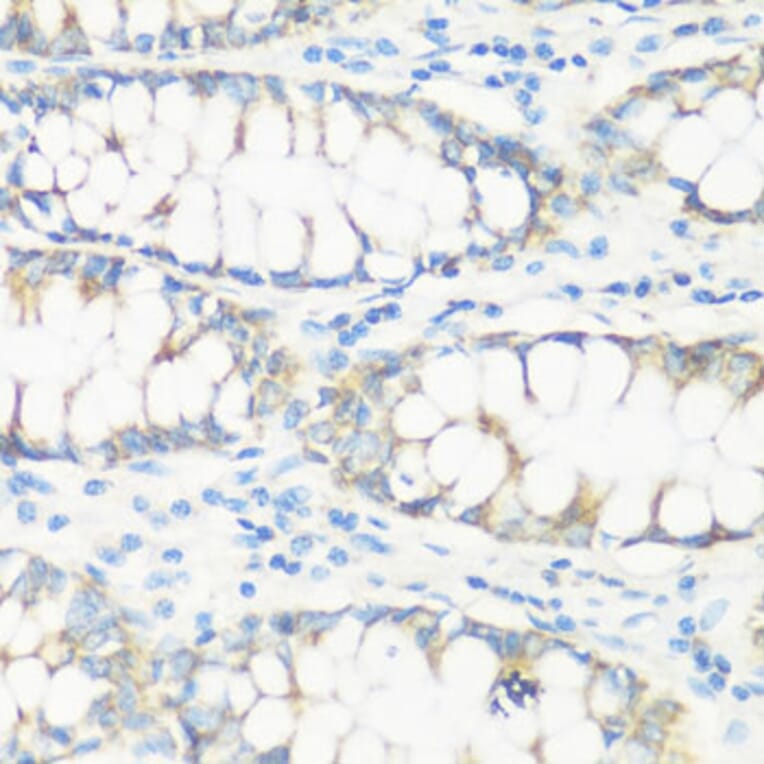 Immunohistochemistry - Anti-NMT1 Antibody (A8724) - Antibodies.com