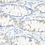 Immunohistochemistry - Anti-NMT1 Antibody (A8724) - Antibodies.com
