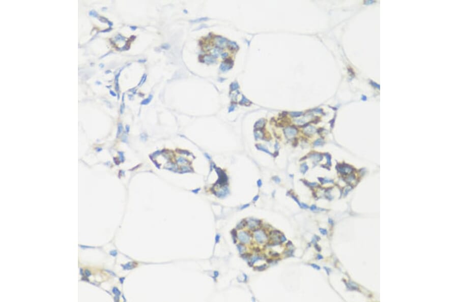 Immunohistochemistry - Anti-NMT1 Antibody (A8724) - Antibodies.com