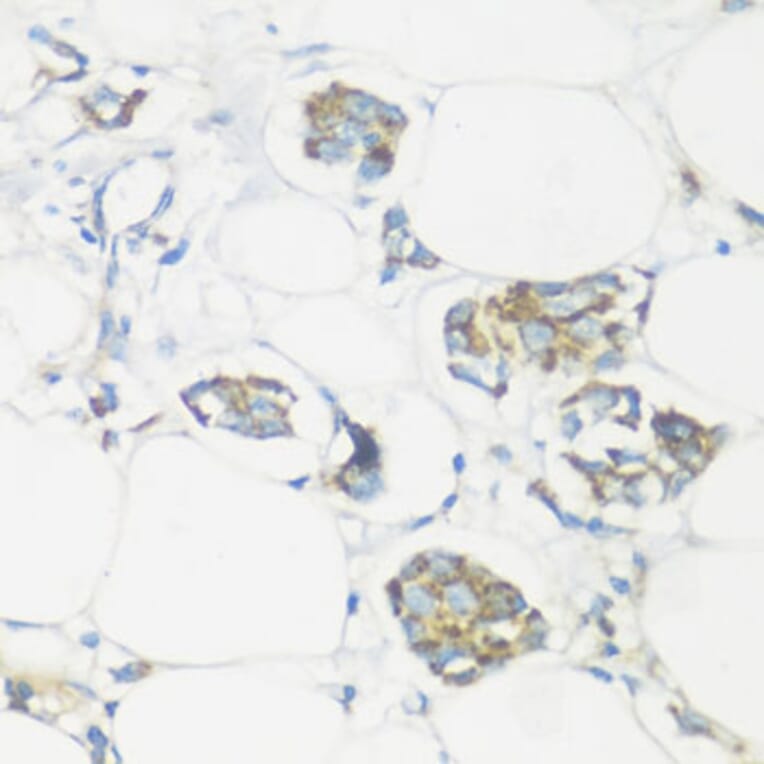Immunohistochemistry - Anti-NMT1 Antibody (A8724) - Antibodies.com