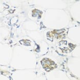 Immunohistochemistry - Anti-NMT1 Antibody (A8724) - Antibodies.com