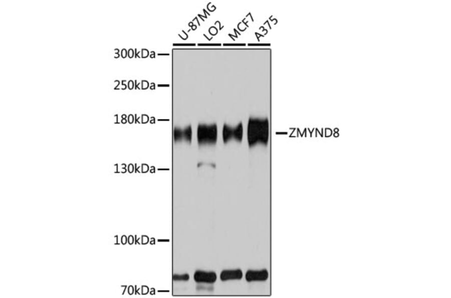 Western Blot - Anti-ZMYND8 Antibody (A12298) - Antibodies.com