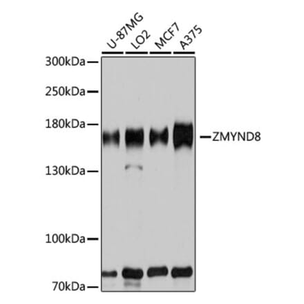 Western Blot - Anti-ZMYND8 Antibody (A12298) - Antibodies.com