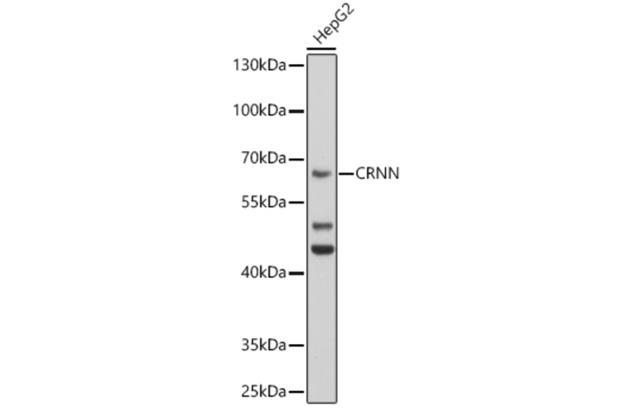 Western Blot - Anti-Cornulin Antibody (A12300) - Antibodies.com