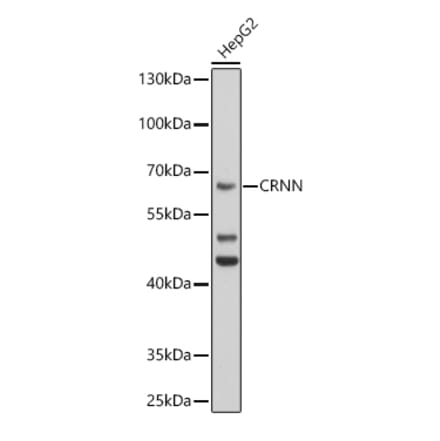 Western Blot - Anti-Cornulin Antibody (A12300) - Antibodies.com