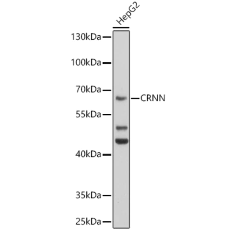 Western Blot - Anti-Cornulin Antibody (A12300) - Antibodies.com
