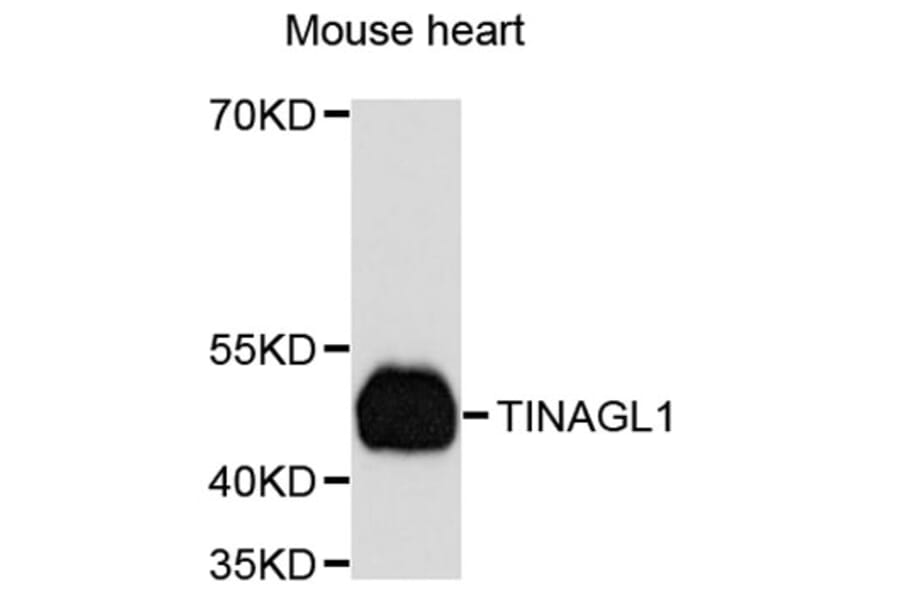 Western Blot - Anti-TINAGL1 Antibody (A8785) - Antibodies.com