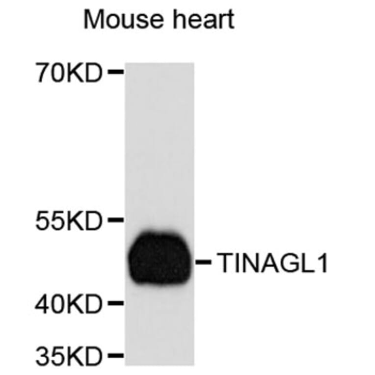 Western Blot - Anti-TINAGL1 Antibody (A8785) - Antibodies.com