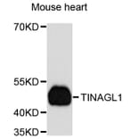 Western Blot - Anti-TINAGL1 Antibody (A8785) - Antibodies.com