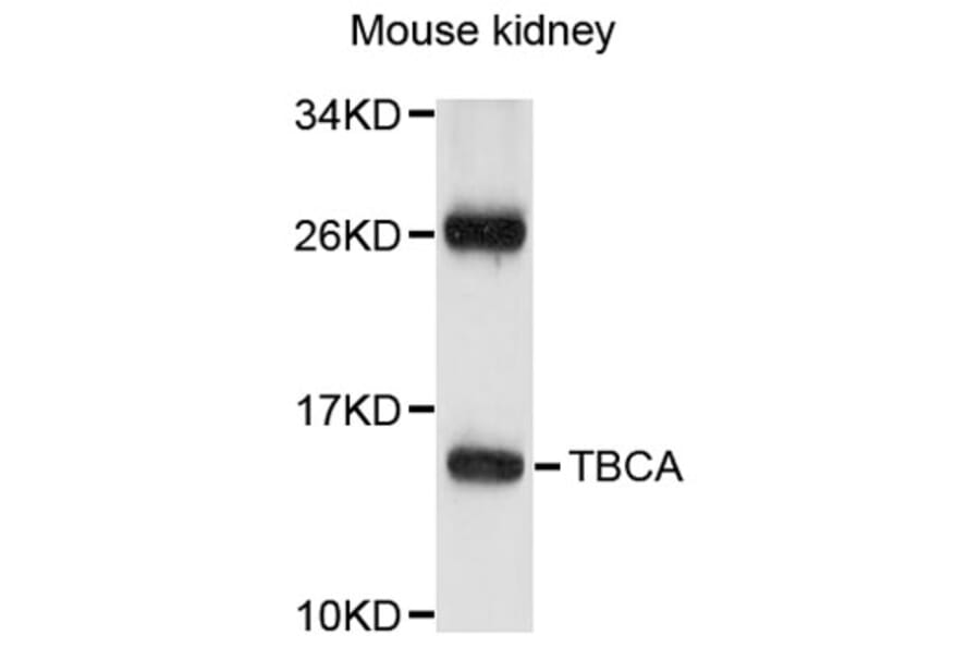 Western Blot - Anti-TBCA Antibody (A8808) - Antibodies.com