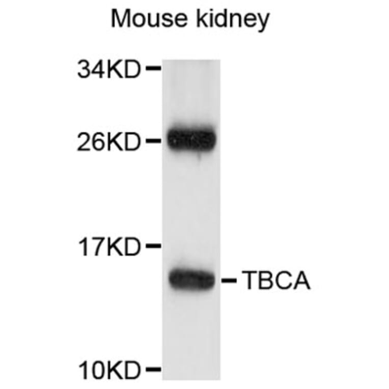 Western Blot - Anti-TBCA Antibody (A8808) - Antibodies.com