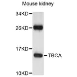Western Blot - Anti-TBCA Antibody (A8808) - Antibodies.com
