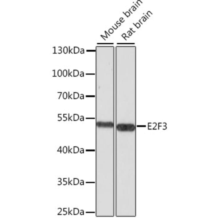 Western Blot - Anti-E2F3 Antibody (A12305) - Antibodies.com