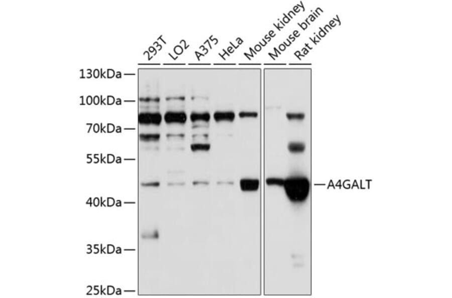 Western Blot - Anti-A4GALT Antibody (A12306) - Antibodies.com