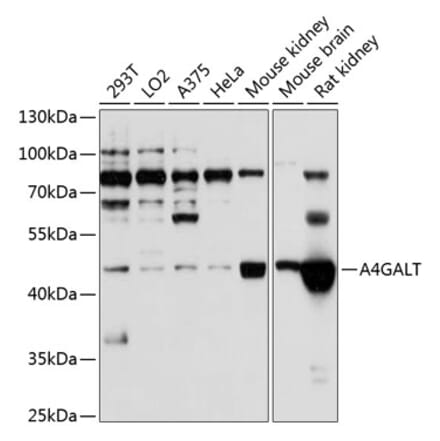 Western Blot - Anti-A4GALT Antibody (A12306) - Antibodies.com