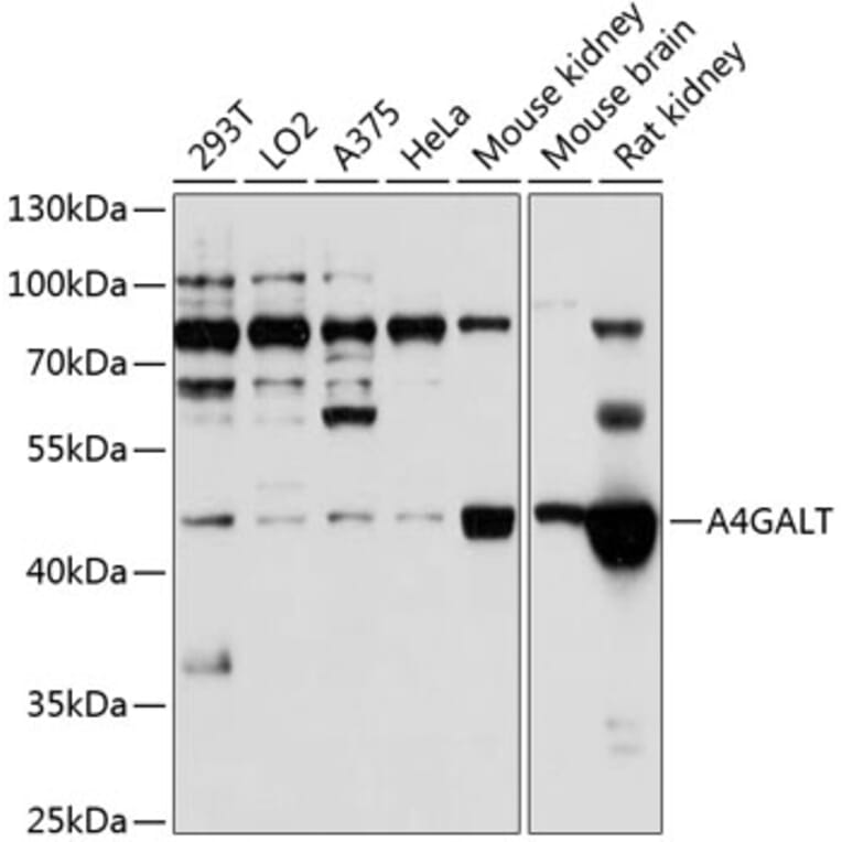 Western Blot - Anti-A4GALT Antibody (A12306) - Antibodies.com