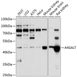Western Blot - Anti-A4GALT Antibody (A12306) - Antibodies.com