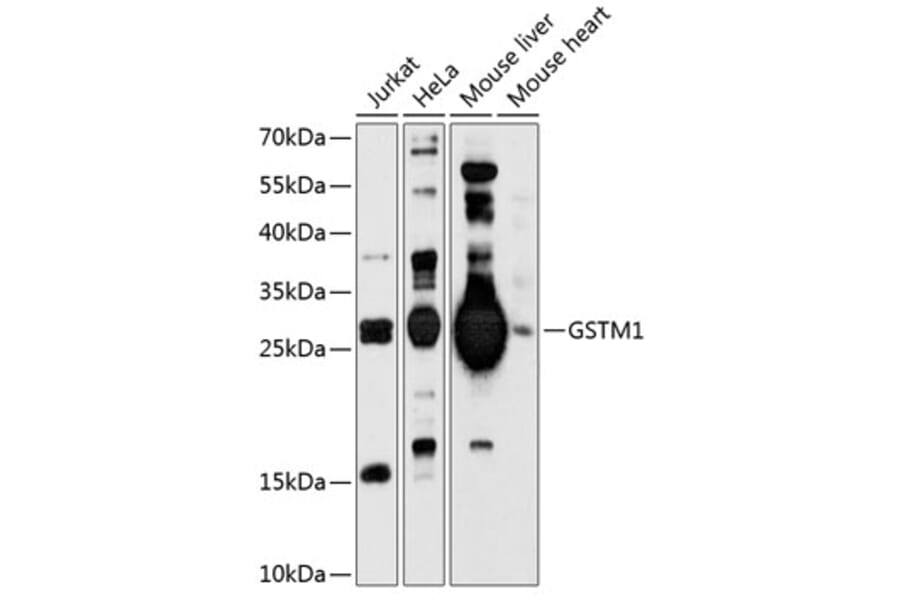 Western Blot - Anti-GSTM1 Antibody (A8819) - Antibodies.com