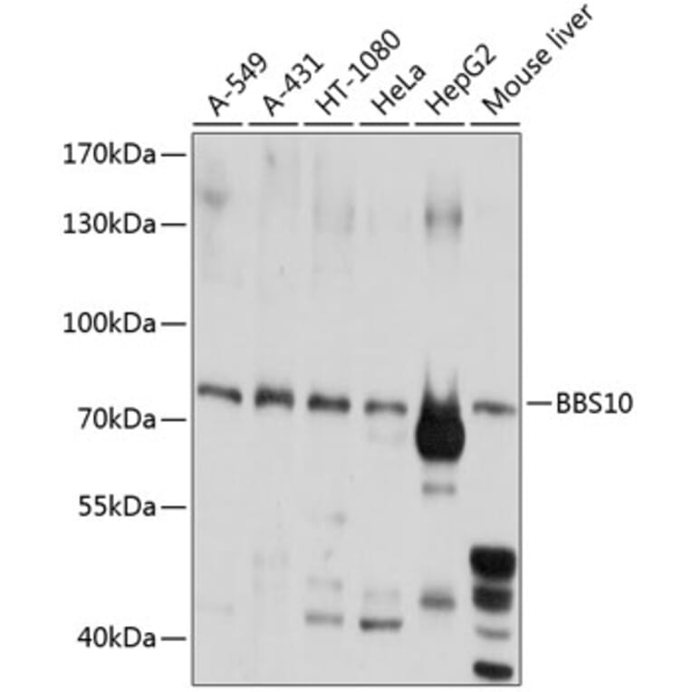 Western Blot - Anti-BBS10 Antibody (A12308) - Antibodies.com